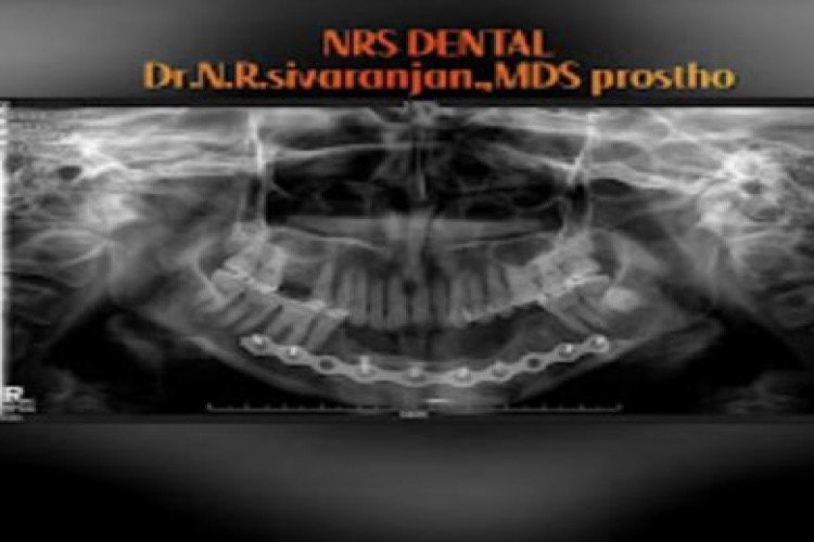 NRS Multi Speciality Dental Hospital in Salem - Salem Ads